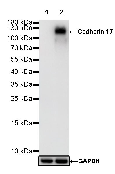 S-RMab® Cadherin 17 Recombinant Rabbit mAb (SDT-736-23)