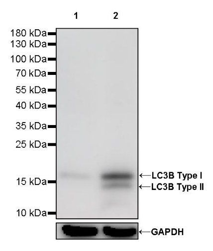 LC3B Recombinant Rabbit mAb (S-477-89)