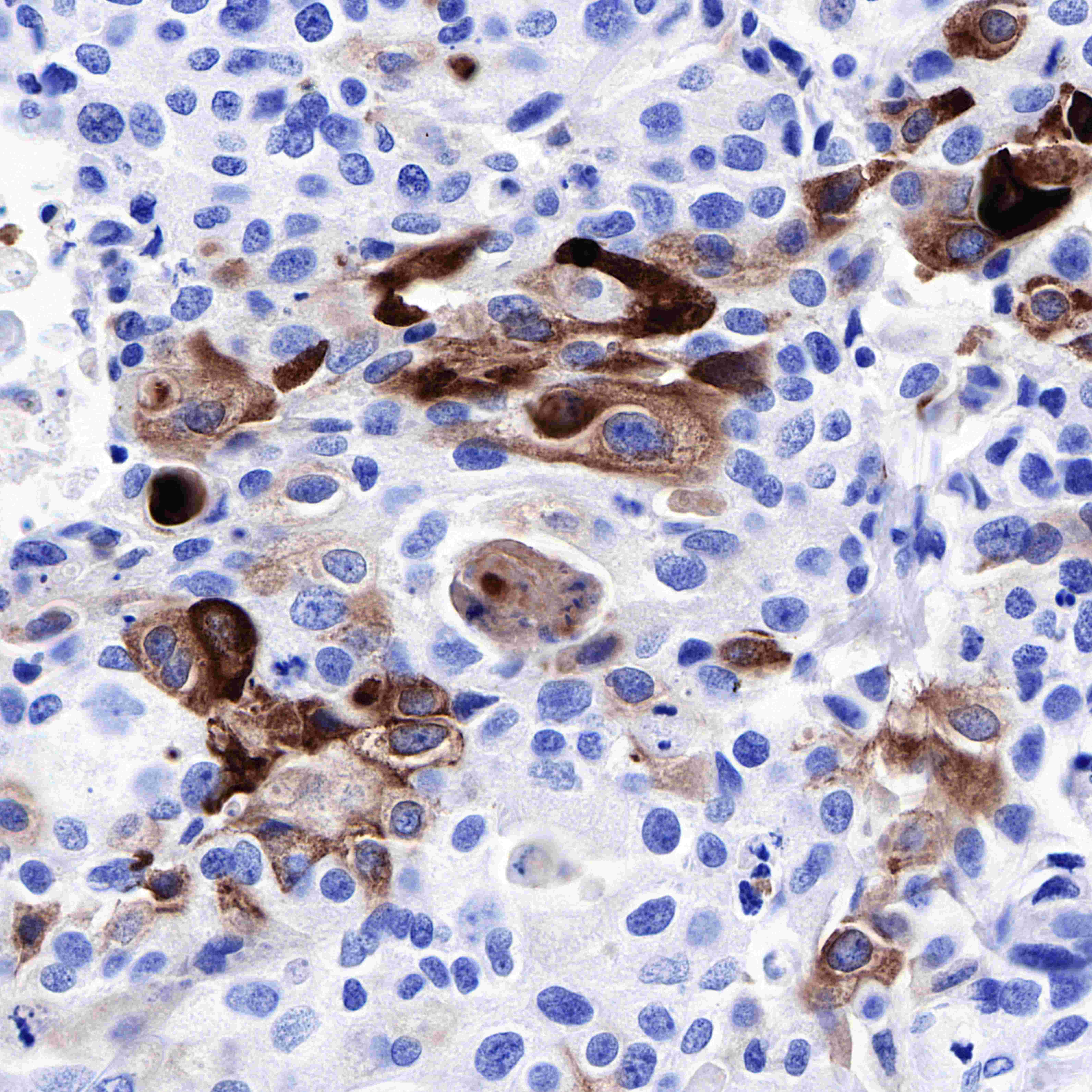 Mammaglobin A Recombinant Rabbit mAb (SDT-R065)