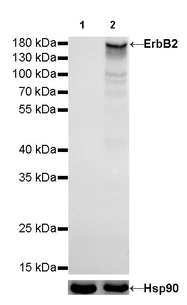 ErbB2 Recombinant Rabbit mAb (SDT-069-10)