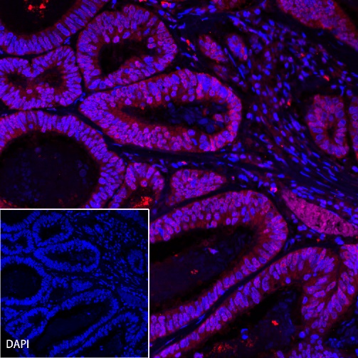 p53 Recombinant Rabbit mAb (Alexa Fluor® 555 Conjugate) (SDT-R118)
