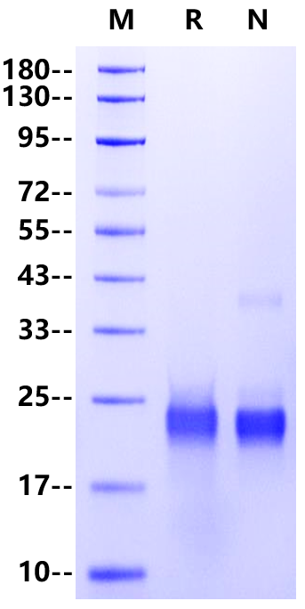 GITR/TNFRSF18 His Tag Protein, Human