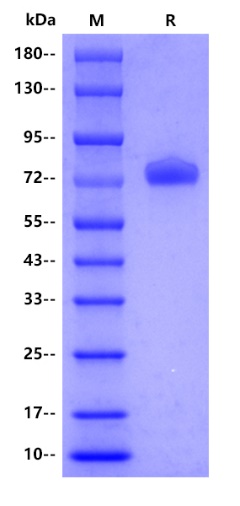 Mouse DLL4 Protein, His tag