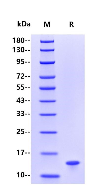 Human β2-microglobulin, His Tag