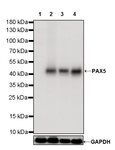 S-RMab® PAX5 Recombinant Rabbit mAb (SDT-R202)