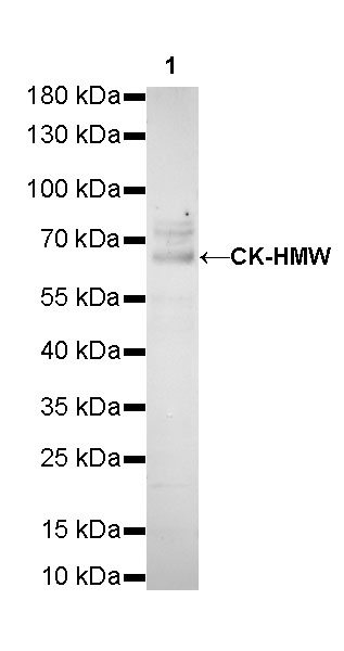 S-RMab® CK-HMW Recombinant Rabbit mAb (SDT-P002)