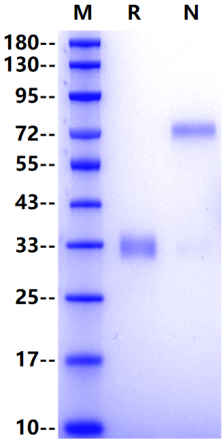 CD72 His Tag Protein, Human