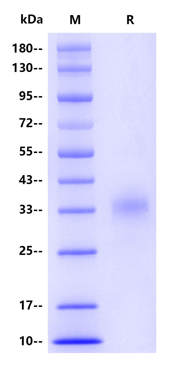 Human CGB3, His tag