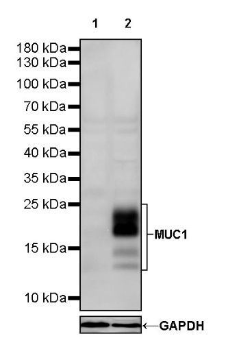 MUC1 Mouse mAb (SDT-777-71)