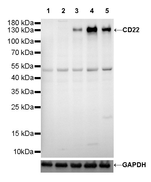 CD22 Recombinant Rabbit mAb (SDT-R113)