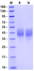 CEACAM-7 His Tag Protein, Human