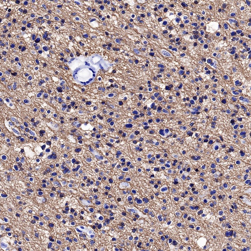 CD56 Recombinant Rabbit mAb (SDT-5000)