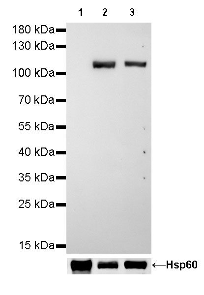 alpha-actinin-2 Recombinant Rabbit mAb (SDT-032-79)
