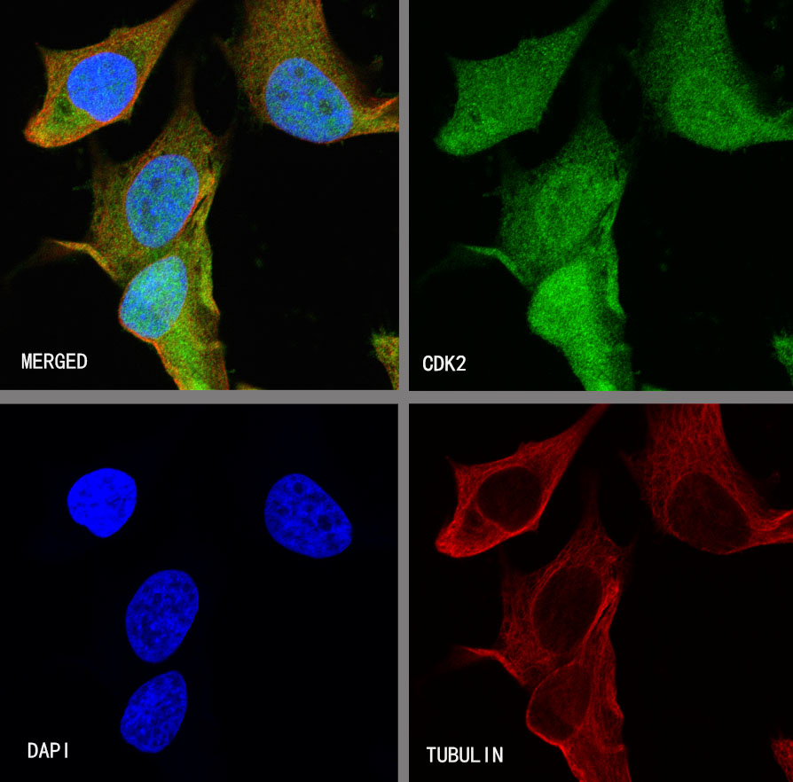 CDK2 Recombinant Rabbit mAb (SDT-064-40)