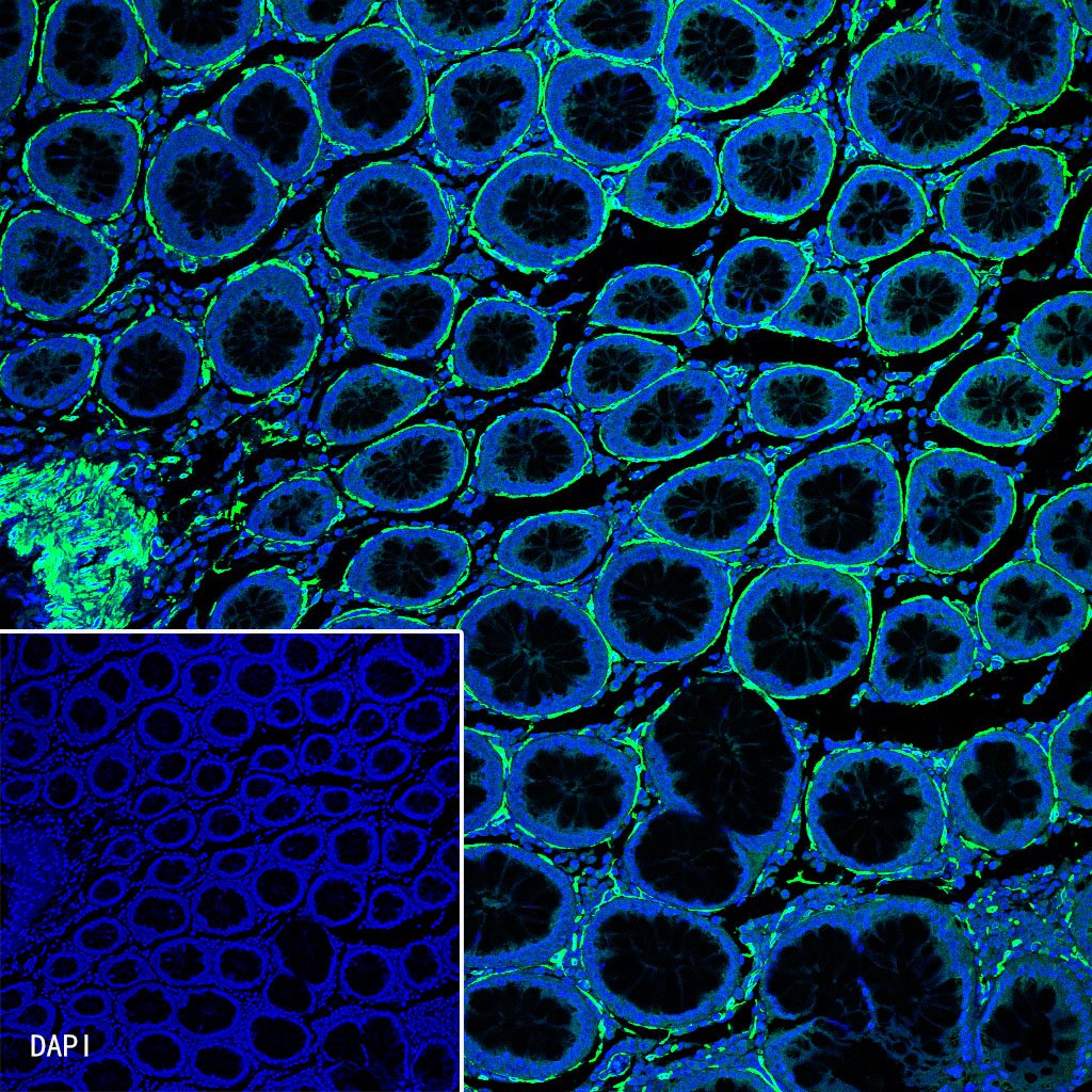 alpha smooth muscle Actin Recombinant Rabbit mAb (FITC Conjugate) (SDT-132-63)
