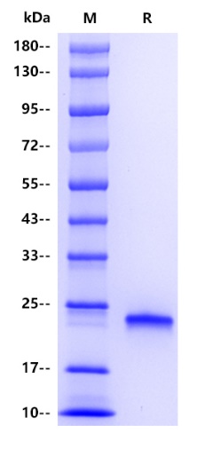 Human IL-28B Protein, His tag