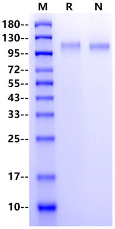 VEGF-R1/Flt-1 His Tag Protein, Human