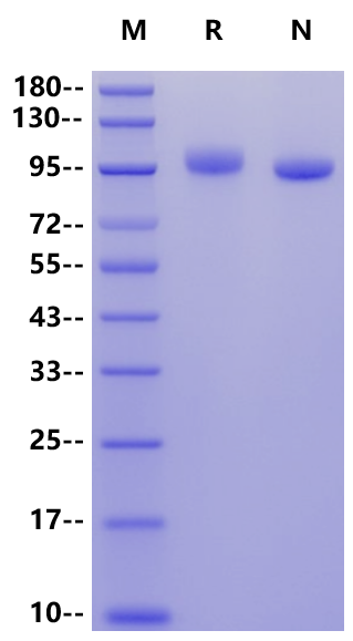 PTK7/CCK4 His Tag Protein, Human
