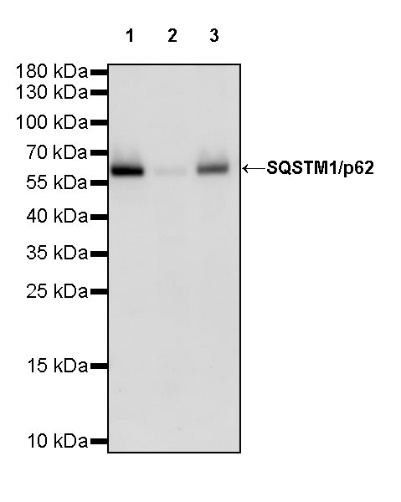 SQSTM1/p62 Recombinant Rabbit mAb (S-778-1)