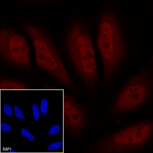 p16 Recombinant Rabbit mAb (Alexa Fluor® 555 Conjugate) (SDT-303-206)