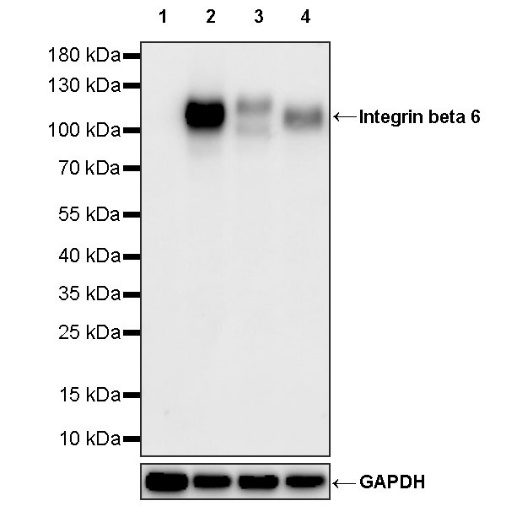 Integrin beta 6 Recombinant Rabbit mAb (SDT-1445-78)