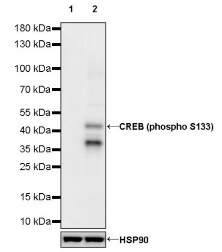 CREB (phospho S133) Recombinant Rabbit mAb (S-1100-102)