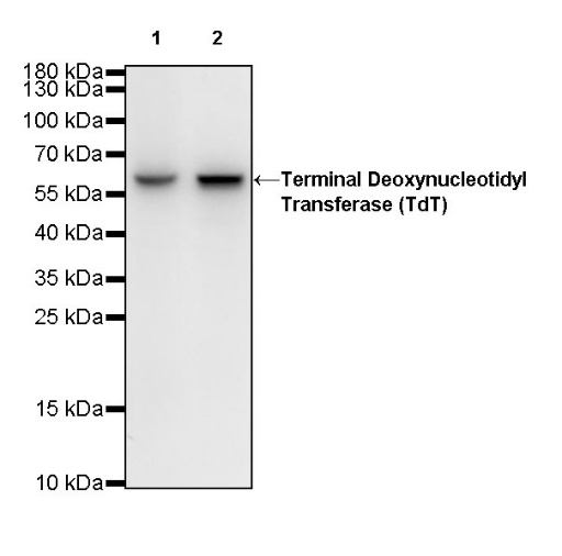 Terminal Deoxynucleotidyl Transferase (TdT) Recombinant Rabbit mAb (S-R245)