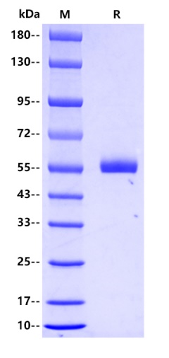 Influenza A virus [A/Thailand/1(KAN-1)/2004(H5N1)] Neuraminidase (NA) Protein, His tag