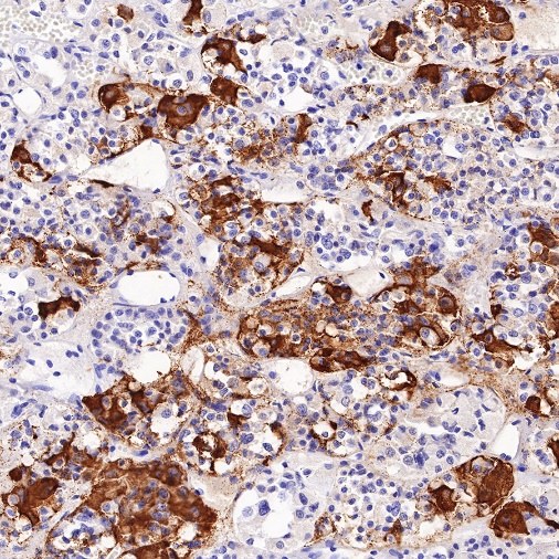 TSHB Recombinant Rabbit mAb (S-537-52)