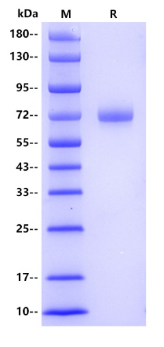 Human Serpin A10 Protein, His tag