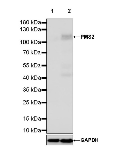 S-RMab® PMS2 Recombinant Rabbit mAb (SDT-R460)