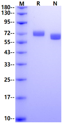 EphA7 His Tag Protein, Human