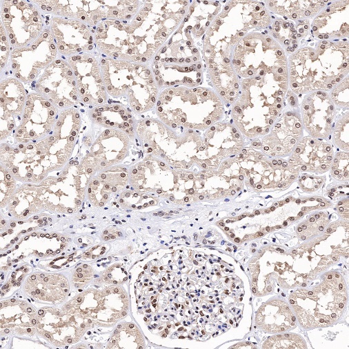 TFE3 Recombinant Rabbit mAb (SDT-760-34)