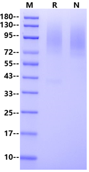 GPC3/Glypican 3 His Tag Protein, Mouse