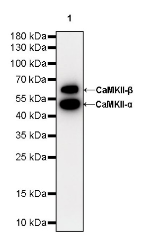 CaMKII-α Recombinant Rabbit mAb (S-R329)