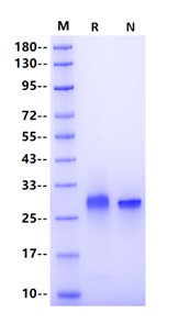 FOLR4 His Tag Protein, Human