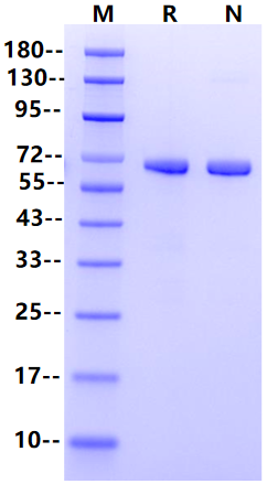 ALPP His Tag Protein, Human