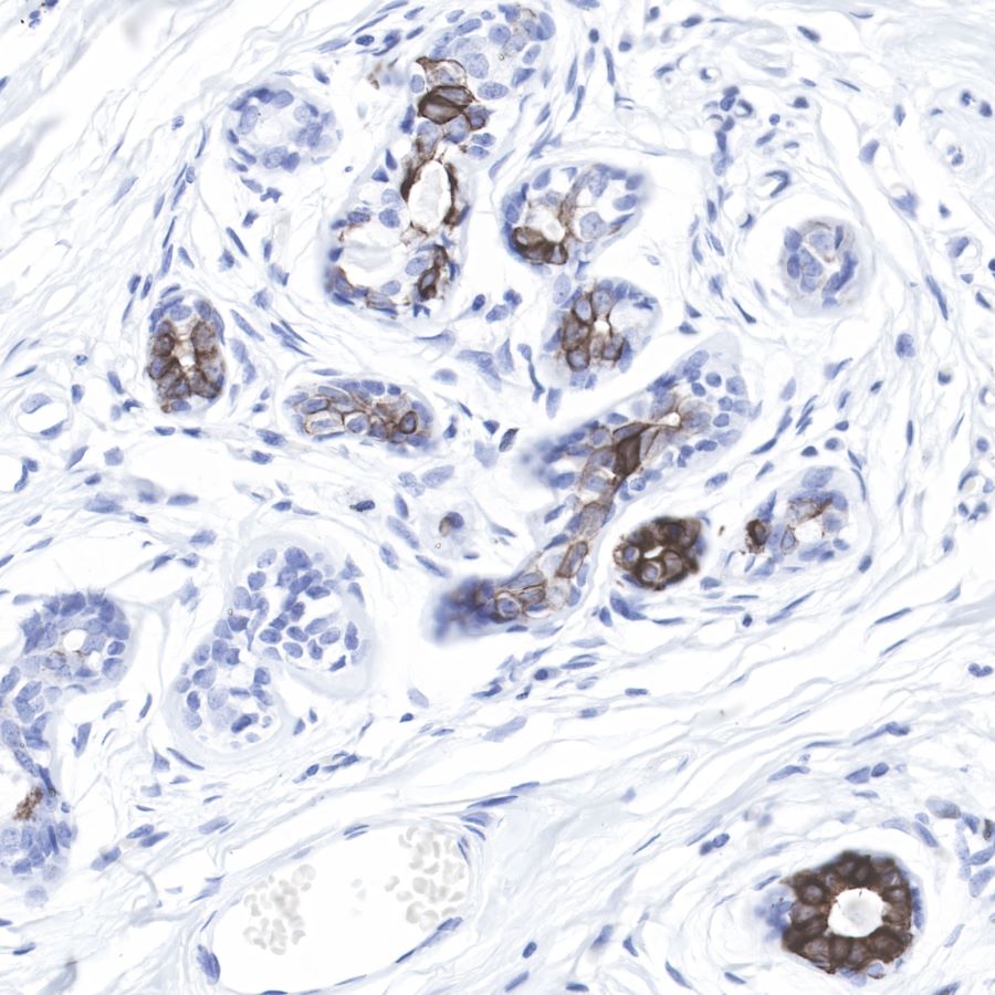 Bax Recombinant Rabbit mAb (SDT-R020)