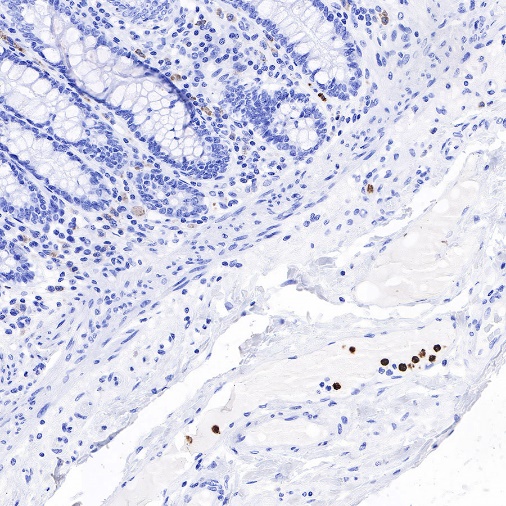 CD66b Recombinant Rabbit mAb (S-766-55)