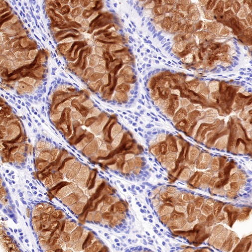 Reg4 Recombinant Rabbit mAb (SDT-1232-23)