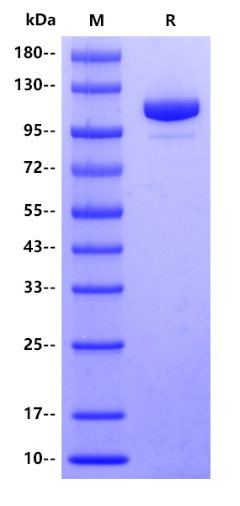 E. coli LacZ Protein, His tag