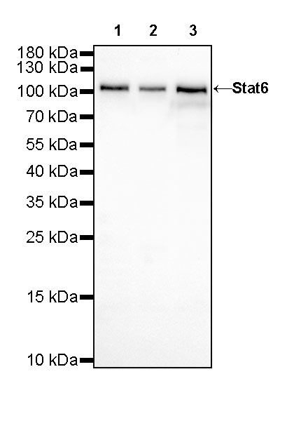 S-RMab® Stat6 Recombinant Rabbit mAb (SDT-337-32)