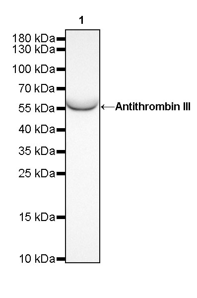 Antithrombin III Recombinant Rabbit mAb (SDT-294-211)