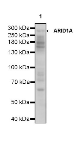 ARID1A Recombinant Rabbit mAb (S-440-62)