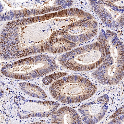 QPRT Recombinant Rabbit mAb (S-1228-31)