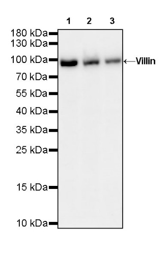 Villin Recombinant Rabbit mAb (SDT-R255)