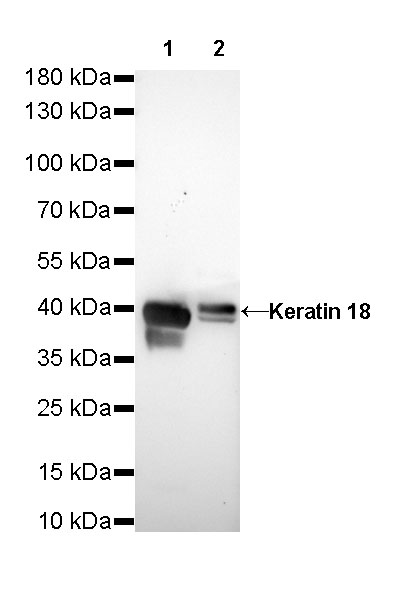 S-RMab® Keratin 18 Recombinant Rabbit mAb (SDT-012-7)