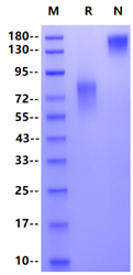 IL-15R alpha/CD215 Fc Chimera Protein, Mouse