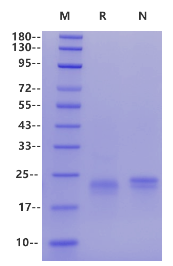 DLL3(312-492aa) His Tag Protein, Human