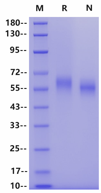 IL-1RAcP/IL-1R3 His Tag Protein, Human